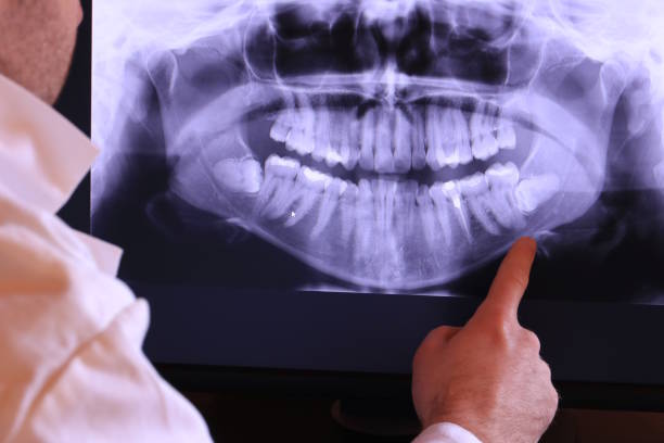 Best Holiday Emergency Dentist in Mount Vernon, GA