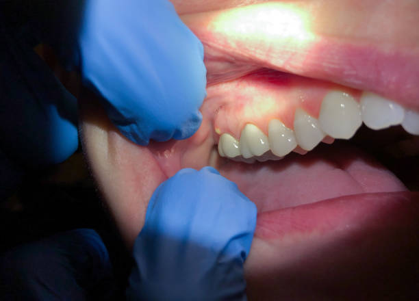  Mount Vernon, GA Emergency Dentist Pros